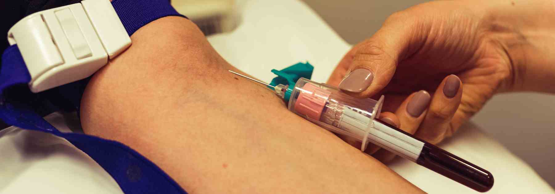 Access private blood testing services in Glenrothes.